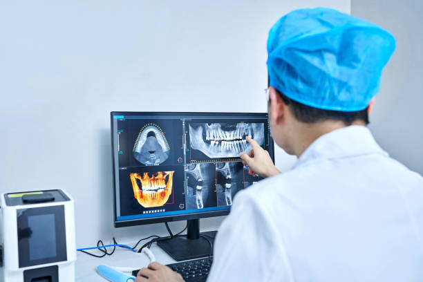Teeth Whitening in WA
